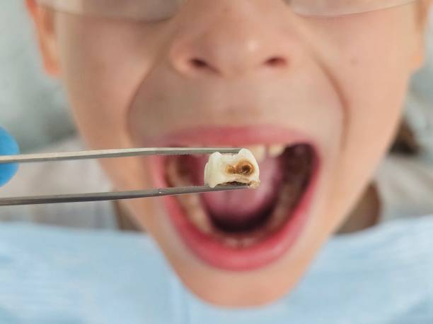 Best Emergency Tooth Extraction  in Moreland, ID